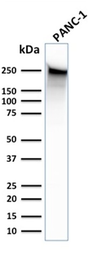 Anti-SPTBN2 antibody [SPTBN2/1583] used in Western Blot (WB). GTX35090