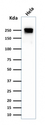 Anti-SPTBN2 antibody [SPTBN2/1584] used in Western Blot (WB). GTX35091
