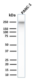 Anti-SPTBN2 antibody [SPTBN2/1584] used in Western Blot (WB). GTX35091