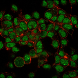 Anti-SUMO1 antibody [SM1/495] used in Immunocytochemistry/ Immunofluorescence (ICC/IF). GTX35092