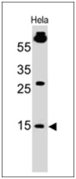 Anti-SUMO1 antibody [SM1/495] used in Western Blot (WB). GTX35092