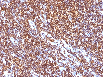 Anti-SUMO1 antibody [SUMO1/1188] used in IHC (Paraffin sections) (IHC-P). GTX35094