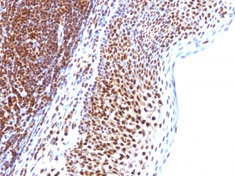 Anti-SUMO1 antibody [SUMO1/1188] used in IHC (Paraffin sections) (IHC-P). GTX35094