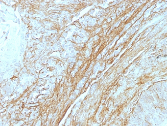Anti-Tenascin C antibody [T2H5] used in IHC (Paraffin sections) (IHC-P). GTX35097