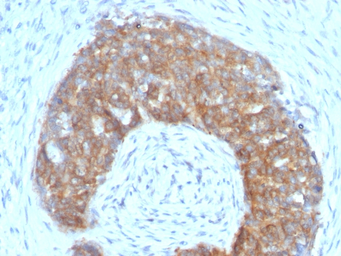 Anti-TFF1 antibody [SPM313] used in IHC (Paraffin sections) (IHC-P). GTX35100