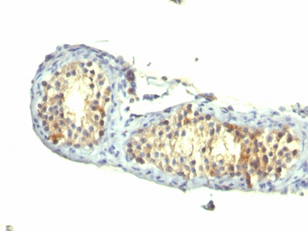 Anti-TGF alpha antibody [1E8-G6] used in IHC (Paraffin sections) (IHC-P). GTX35103