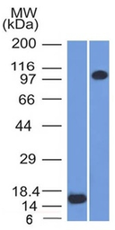 Anti-Thrombomodulin antibody [THBD/1591] used in Western Blot (WB). GTX35108
