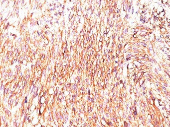 Anti-TMEM16A antibody [DOG-1.1] used in IHC (Paraffin sections) (IHC-P). GTX35127