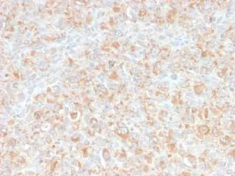 Anti-TNF alpha antibody [SPM543] used in IHC (Paraffin sections) (IHC-P). GTX35132