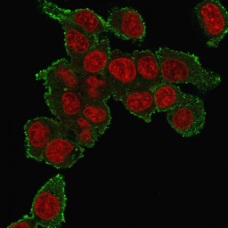 Anti-TNF alpha antibody [TNF706] used in Immunocytochemistry/ Immunofluorescence (ICC/IF). GTX35134