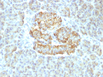 Anti-TNF alpha antibody [TNF/1500R] used in IHC (Paraffin sections) (IHC-P). GTX35135
