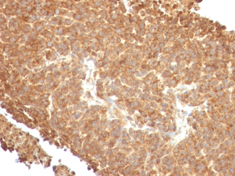 Anti-TOP1MT antibody [TOP1MT/488] used in IHC (Paraffin sections) (IHC-P). GTX35136