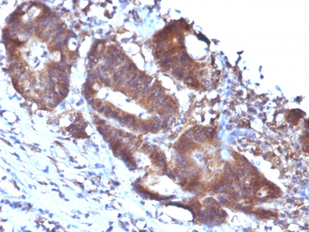 Anti-Transgelin antibody [TAGLN/247] used in IHC (Paraffin sections) (IHC-P). GTX35141