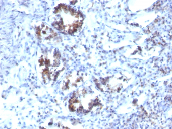 Anti-Transgelin antibody [SPM606] used in IHC (Paraffin sections) (IHC-P). GTX35142