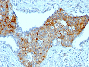 Anti-TRIM29 antibody [TRIM29/1041] used in IHC (Paraffin sections) (IHC-P). GTX35147