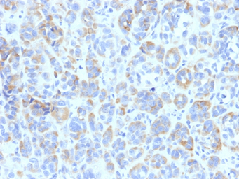 Anti-TRP1 antibody [TYRP1/807] used in IHC (Paraffin sections) (IHC-P). GTX35149