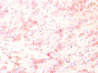 Anti-TRP1 antibody [TYRP1/1564R] used in IHC (Paraffin sections) (IHC-P). GTX35151