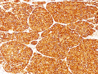 Anti-Tyrosinase antibody [T311] used in IHC (Paraffin sections) (IHC-P). GTX35154