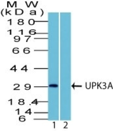 Anti-UPK3A antibody used in Western Blot (WB). GTX35157