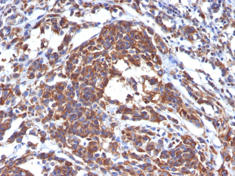 Anti-Vimentin antibody [LN-6] used in IHC (Paraffin sections) (IHC-P). GTX35162