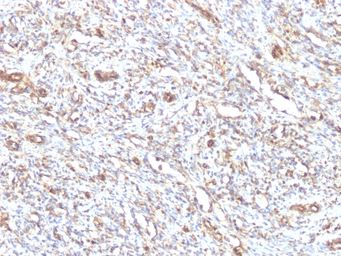 Anti-Vimentin antibody [VM1170] used in IHC (Paraffin sections) (IHC-P). GTX35163