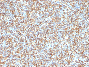 Anti-Vimentin antibody [VM1170] used in IHC (Paraffin sections) (IHC-P). GTX35163