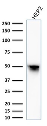 Anti-Vimentin antibody [VM1170] used in Western Blot (WB). GTX35163