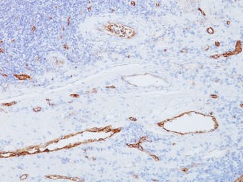 Anti-VWF antibody [3E2D10] used in IHC (Paraffin sections) (IHC-P). GTX35165