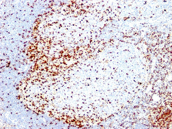 Anti-ZAP70 antibody [2F3.2] used in IHC (Paraffin sections) (IHC-P). GTX35177
