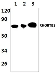 Anti-RHOBTB3 antibody used in Western Blot (WB). GTX35184