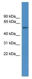 Anti-TTYH3 antibody used in Western Blot (WB). GTX35188