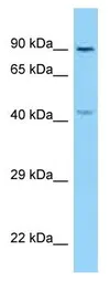Anti-KIF3B antibody used in Western Blot (WB). GTX35189
