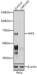 Anti-YAP1 antibody used in Western Blot (WB). GTX35195