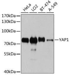 Anti-YAP1 antibody used in Western Blot (WB). GTX35195
