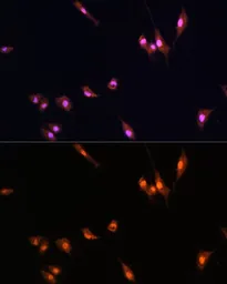 Anti-YAP1 antibody used in Immunocytochemistry/ Immunofluorescence (ICC/IF). GTX35195