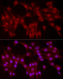 Anti-YAP1 antibody used in Immunocytochemistry/ Immunofluorescence (ICC/IF). GTX35195