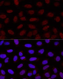 Anti-YAP1 antibody used in Immunocytochemistry/ Immunofluorescence (ICC/IF). GTX35195