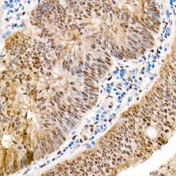 Anti-YAP1 antibody used in IHC (Paraffin sections) (IHC-P). GTX35195
