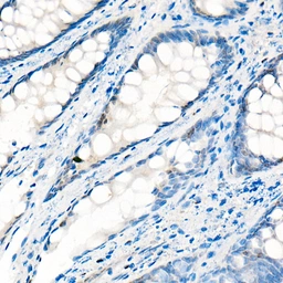 Anti-YAP1 antibody used in IHC (Paraffin sections) (IHC-P). GTX35195