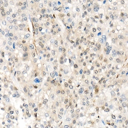 Anti-YAP1 antibody used in IHC (Paraffin sections) (IHC-P). GTX35195