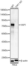 Anti-YAP1 antibody used in Western Blot (WB). GTX35195