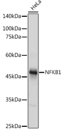 Anti-NFkB p105 antibody used in Western Blot (WB). GTX35196