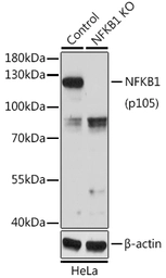 Anti-NFkB p105 antibody used in Western Blot (WB). GTX35196