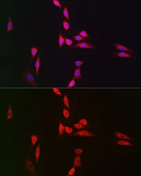 Anti-NFkB p105 antibody used in Immunocytochemistry/ Immunofluorescence (ICC/IF). GTX35196
