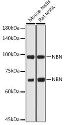 Anti-NBS1 antibody used in Western Blot (WB). GTX35197