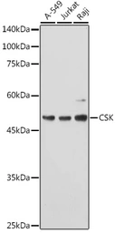Anti-CSK antibody used in Western Blot (WB). GTX35201