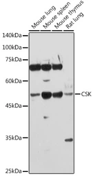 Anti-CSK antibody used in Western Blot (WB). GTX35201