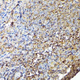 Anti-CSK antibody used in IHC (Paraffin sections) (IHC-P). GTX35201