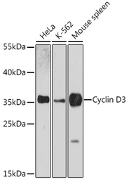 Anti-Cyclin D3 antibody used in Western Blot (WB). GTX35203