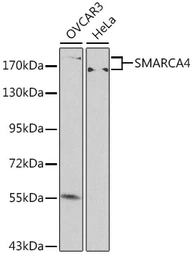Anti-BRG1 antibody used in Western Blot (WB). GTX35204